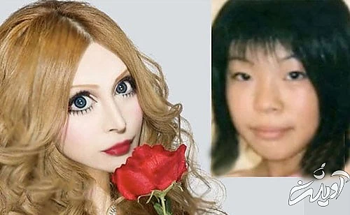 عجیبترین و مضحکترین جراحیهای زیبایی